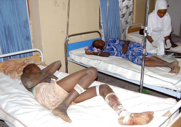 Victims of  a suicide bomb attack at a refugee camp receive treatment, at a hospital in  Maiduguri, Nigeria, Wednesday, Feb. 10, 2016. Two female suicide bombers blew themselves up in a northeast Nigerian refugee camp, killing at least 56 people, health and rescue officials said Wednesday. (AP Photo/Jossy Ola)