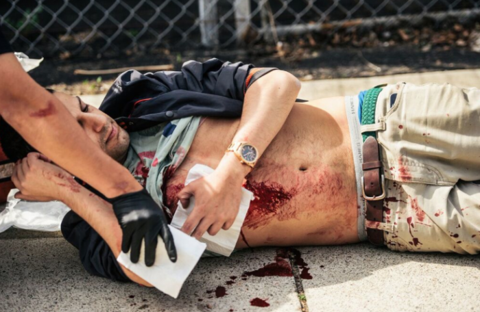 In this photo provided by OC Weekly, a stabbing victim receives first aid from an Anaheim Police Officer, at Pearson Park in Anaheim on Saturday, Feb. 27, 2016. Three people were stabbed Saturday, one critically, after a small group of Ku Klux Klan members staging an anti-immigrant rally clashed with a larger gathering of counter-protesters, police said. (Eric Hood/OC Weekly via AP)