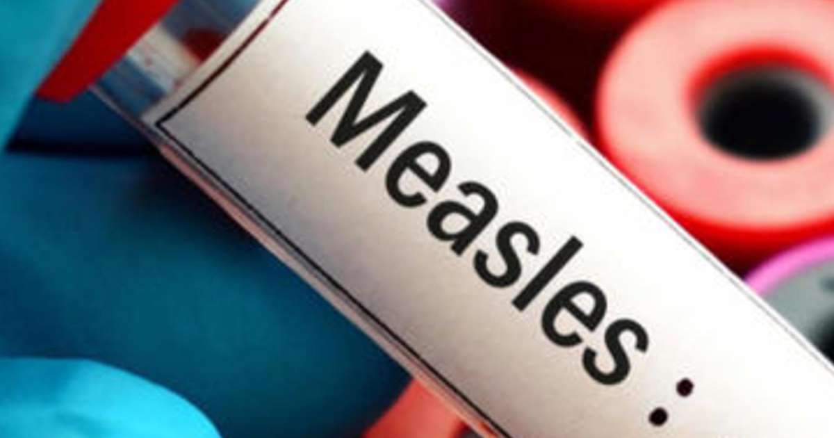 Health Officials Offering Free Vaccinations to Contain Spread of Measles