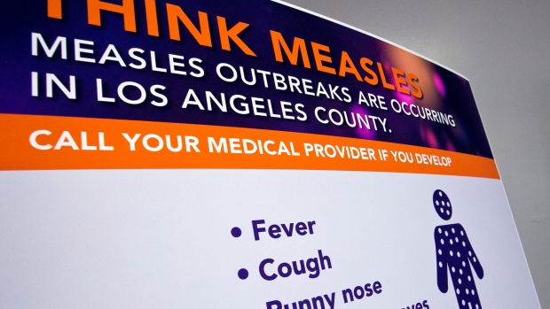 ALERT: Over 1,000 Quarantined in Measles Scare at LA Universities