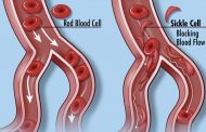 FDA Approves Groundbreaking Cell-Based Gene Therapies for Sickle Cell Disease